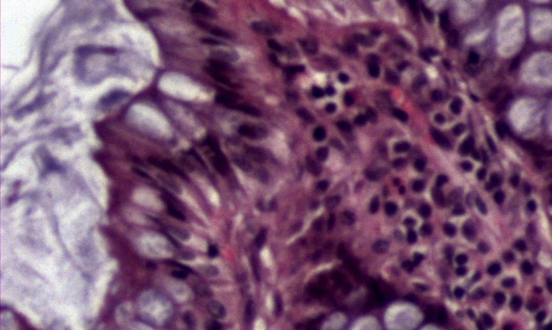 Duodenum, trichrome, high magnification: goblet cell and enterocytes with brush border