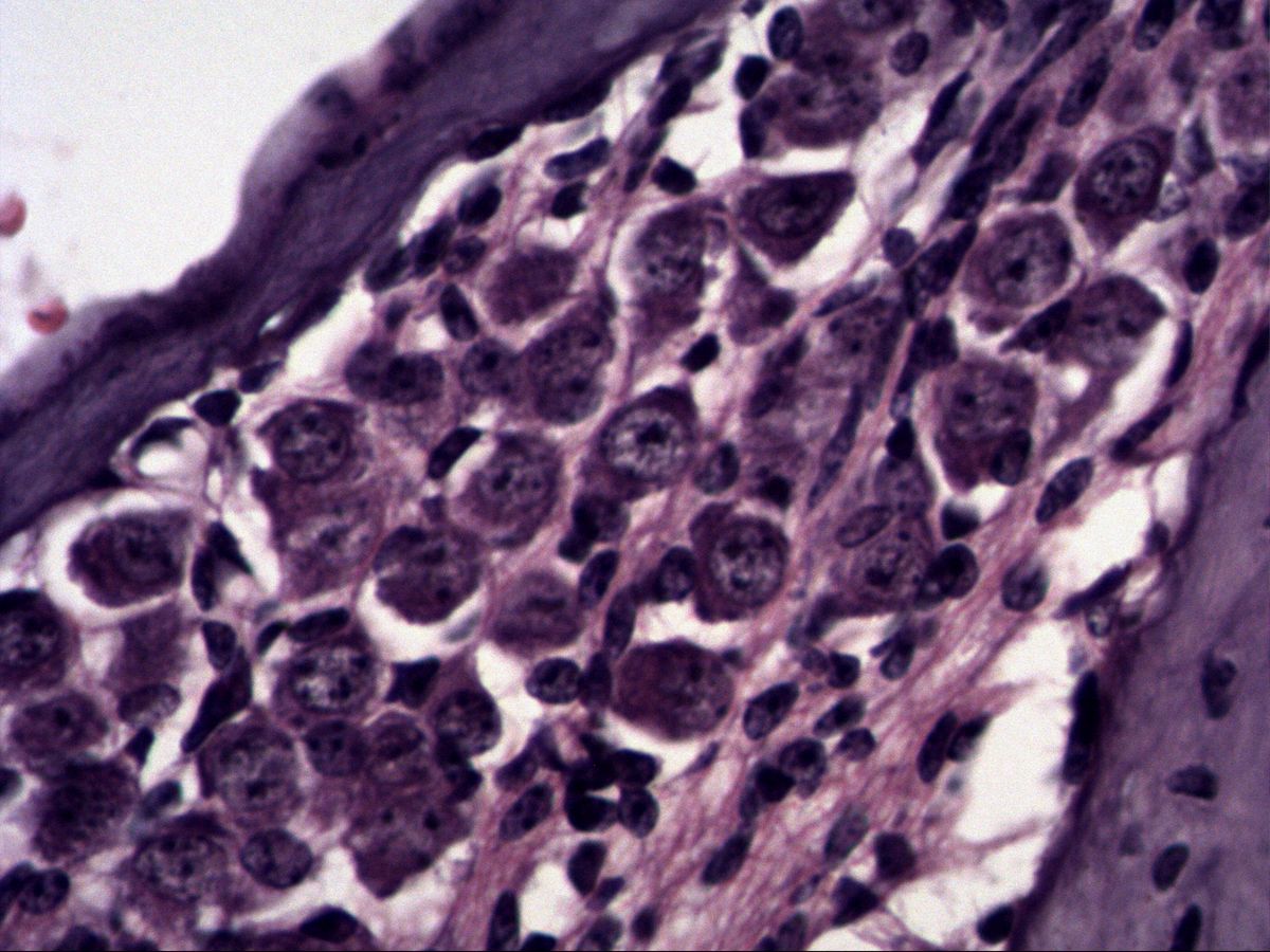 Spiral ganglion, H&E, high magnification, bipolar neurons with nucleolus