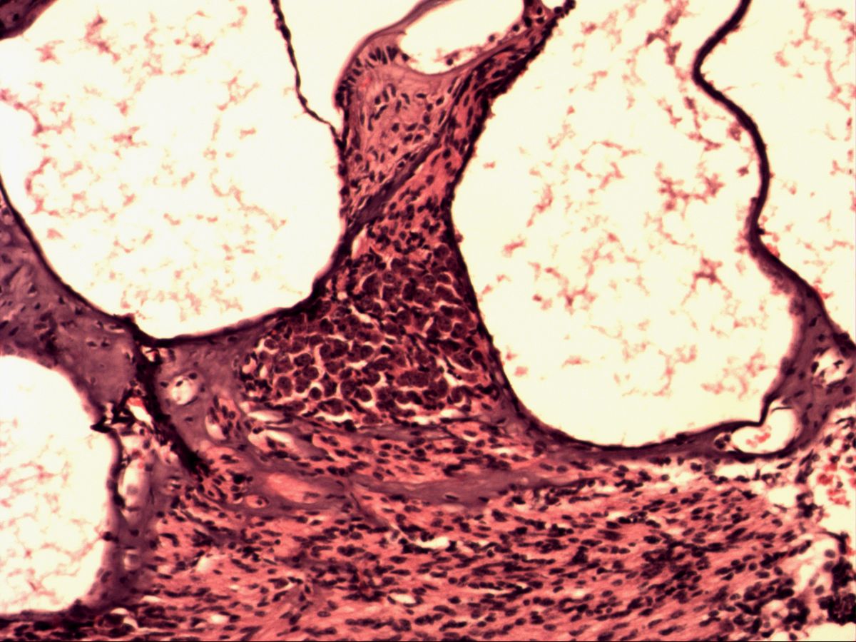 Cochlea, H&E, overview: spiral ganglion at the base of the osseous spiral lamina