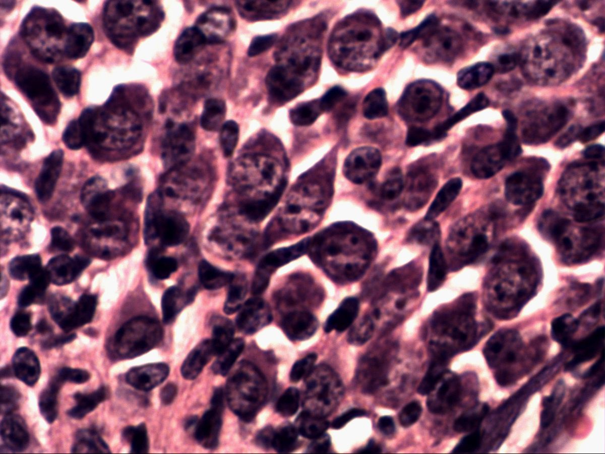 Spiral ganglion, H&E, high magnification, densely packed neurons