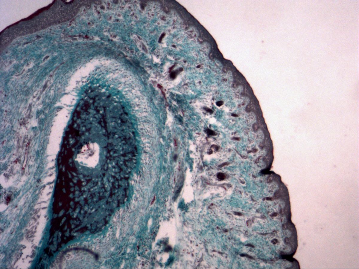 Fetal finger, trichrome, overview with ossifying skeletal element, marrow space and skin