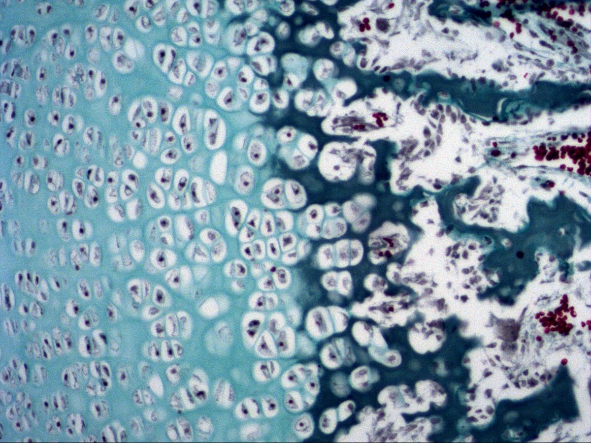 Hypertrophic cartilage and zone of erosion with calcified septa, fetal phalanx, trichrome, high magnification