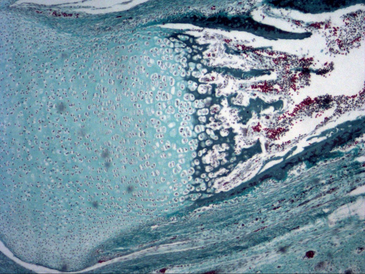 Ossification front of fetal phalanx, trichrome, with cartilage zones, marrow cavity and bone collar