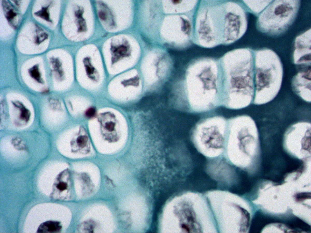 Hypertrophic chondrocytes and calcified cartilage matrix, fetal phalanx, trichrome, very high magnification