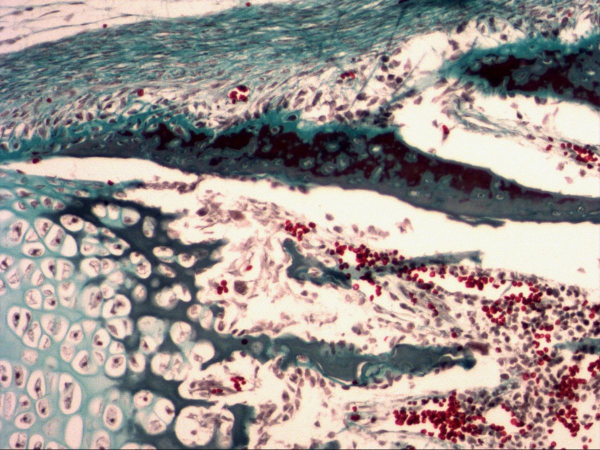 Bone collar, hypertrophic cartilage and primary marrow cavity, fetal phalanx, trichrome, medium magnification