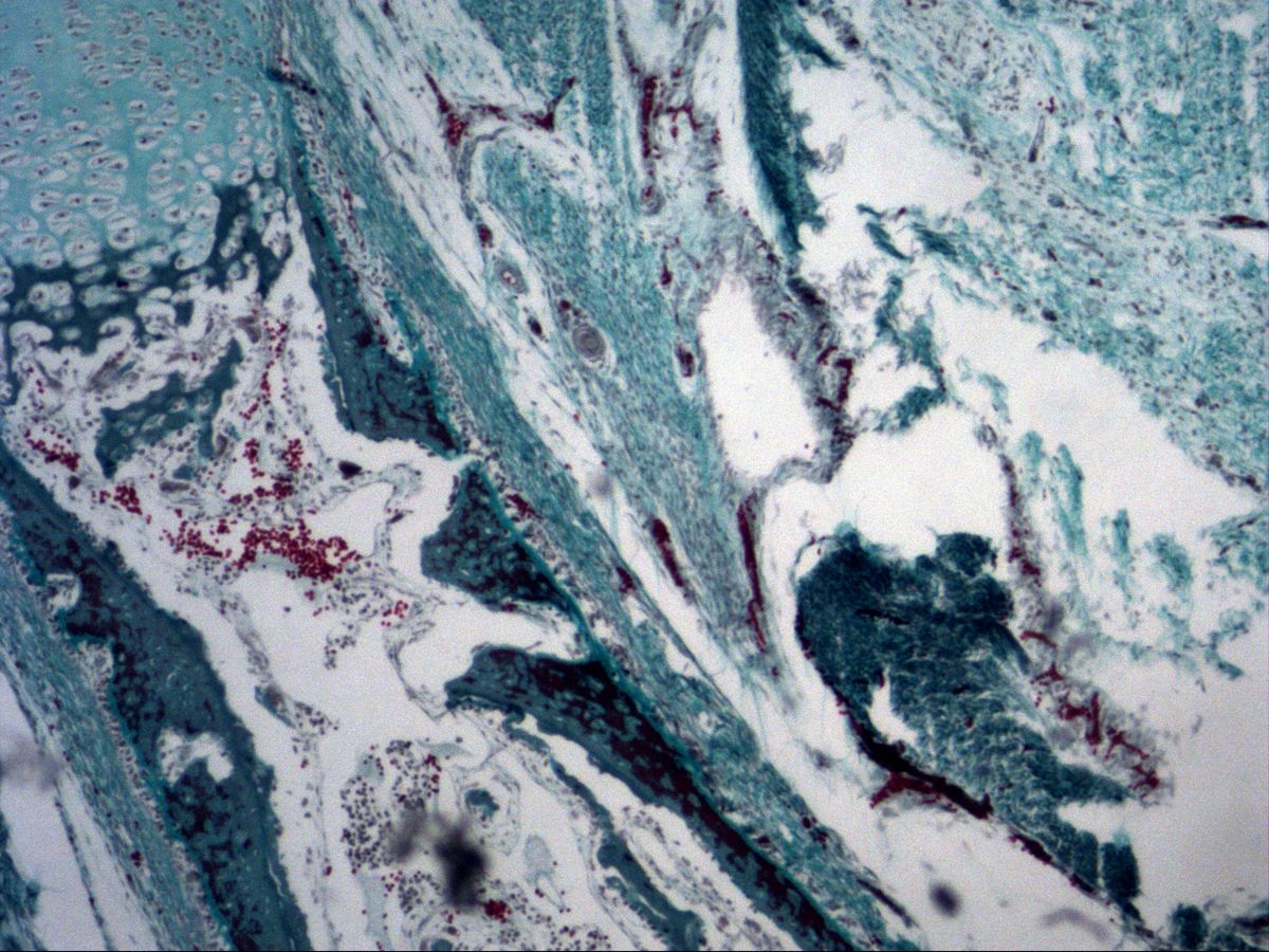 Bone trabeculae and marrow space at the edge of the fetal diaphysis, trichrome, medium magnification