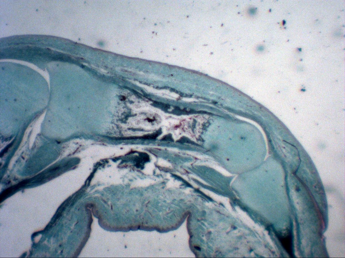Fetal finger, trichrome, overview with cartilaginous phalanges, joint cleft and ossification centre