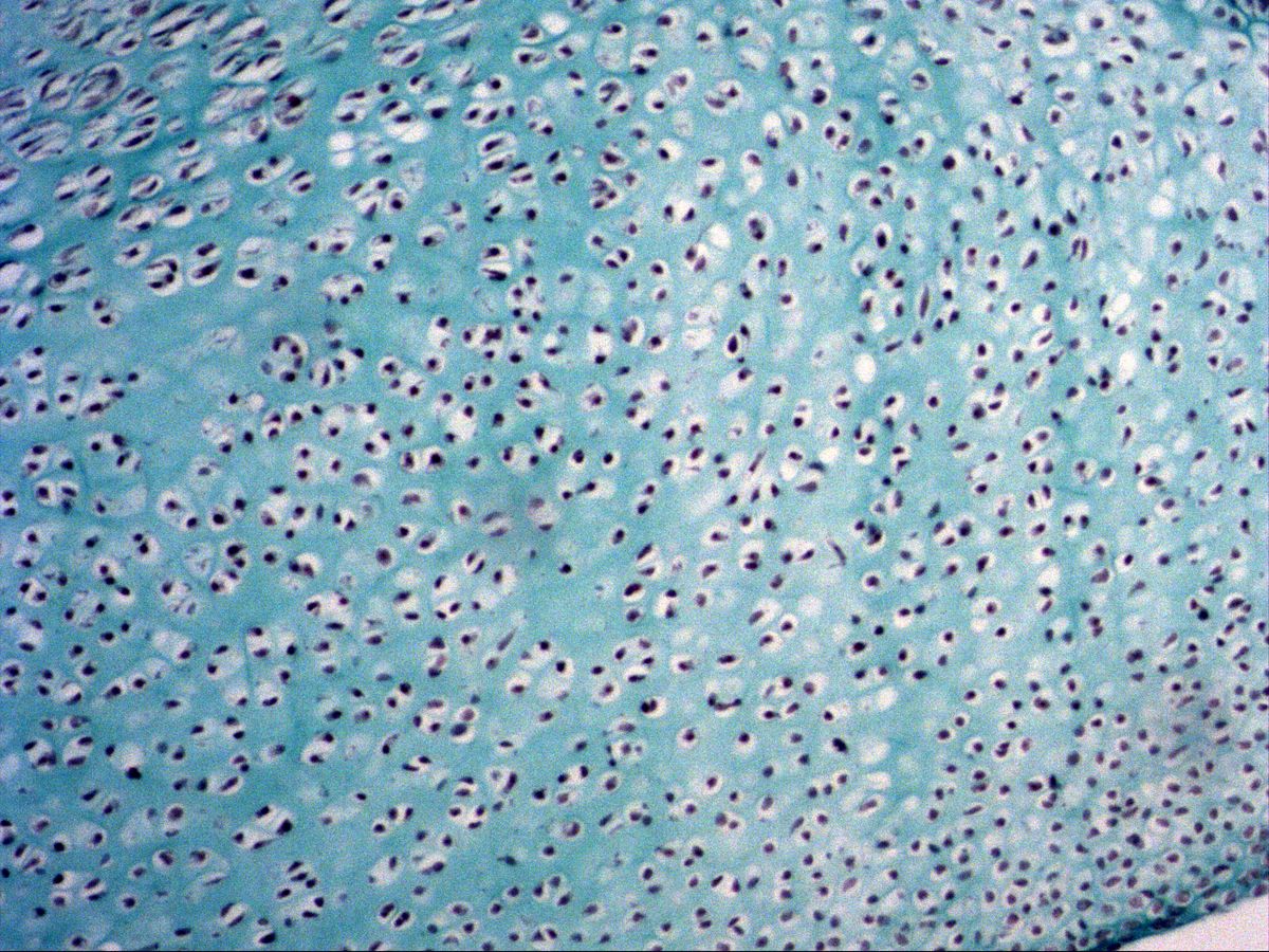 Reserve zone of fetal phalanx, hyaline cartilage, trichrome, medium magnification