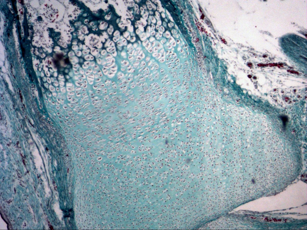 Fetal phalanx, trichrome, zones of endochondral ossification from reserve zone to zone of erosion
