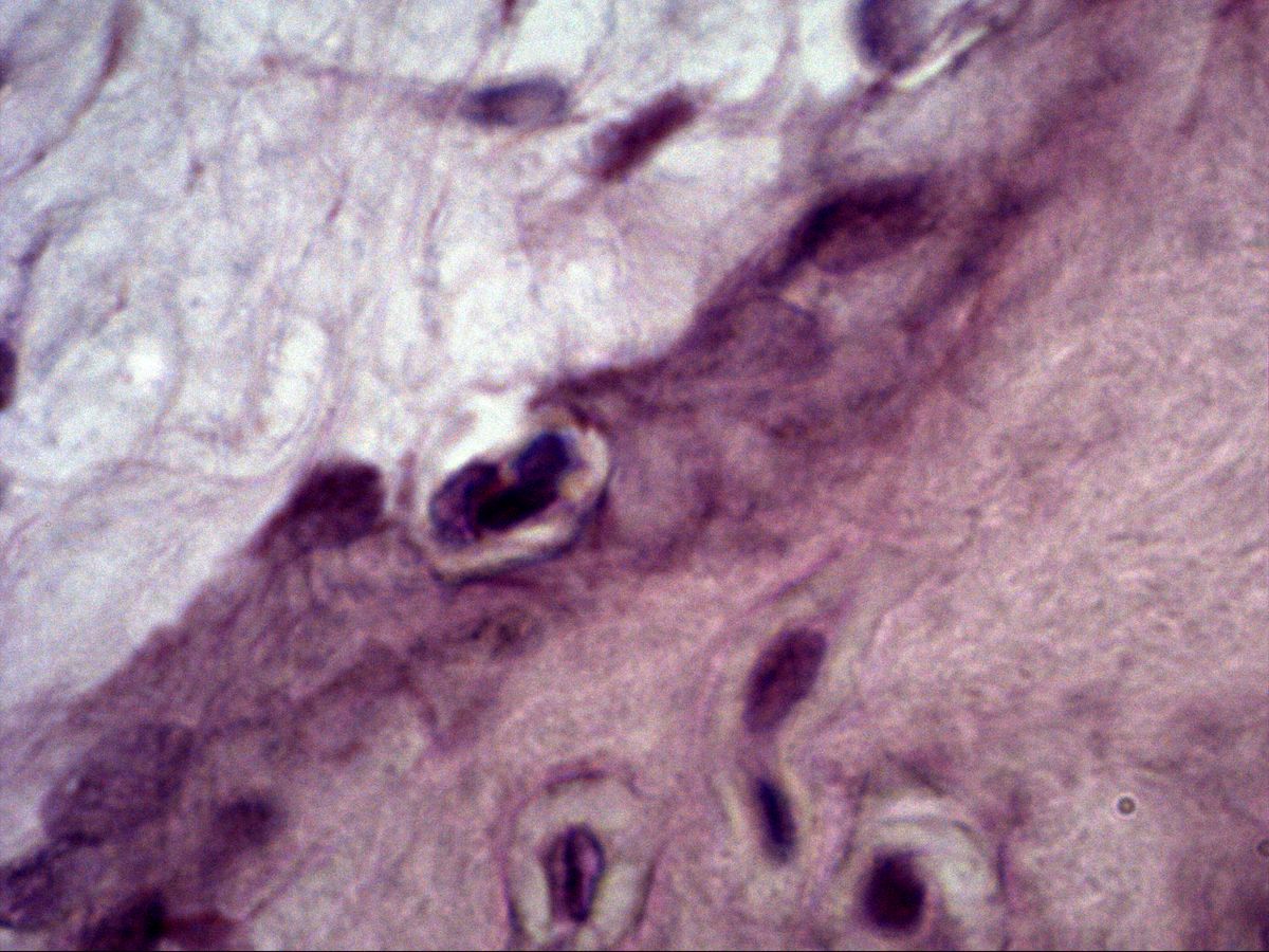 Osteoblasts and osteocytes at the edge of a bone trabecula, intramembranous ossification, H&E, very high magnification