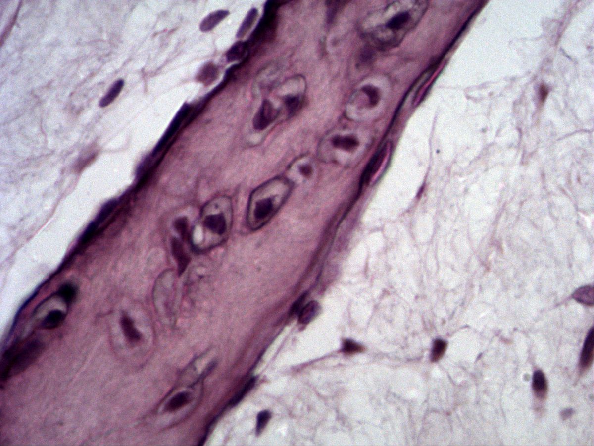 Bone trabecula with osteocytes and osteoblasts in mesenchyme, intramembranous ossification, H&E, high magnification