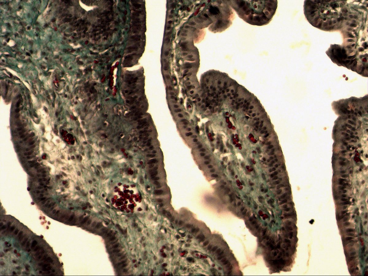 Gallbladder, trichrome, medium magnification: mucosal folds with simple columnar epithelium