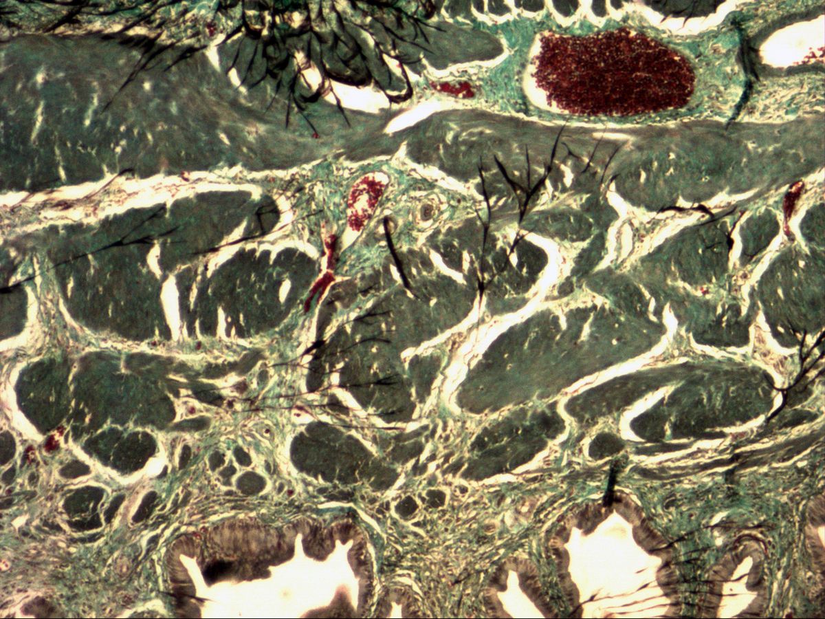 Gallbladder wall, trichrome, overview: smooth muscle bundles, connective tissue and mucosa