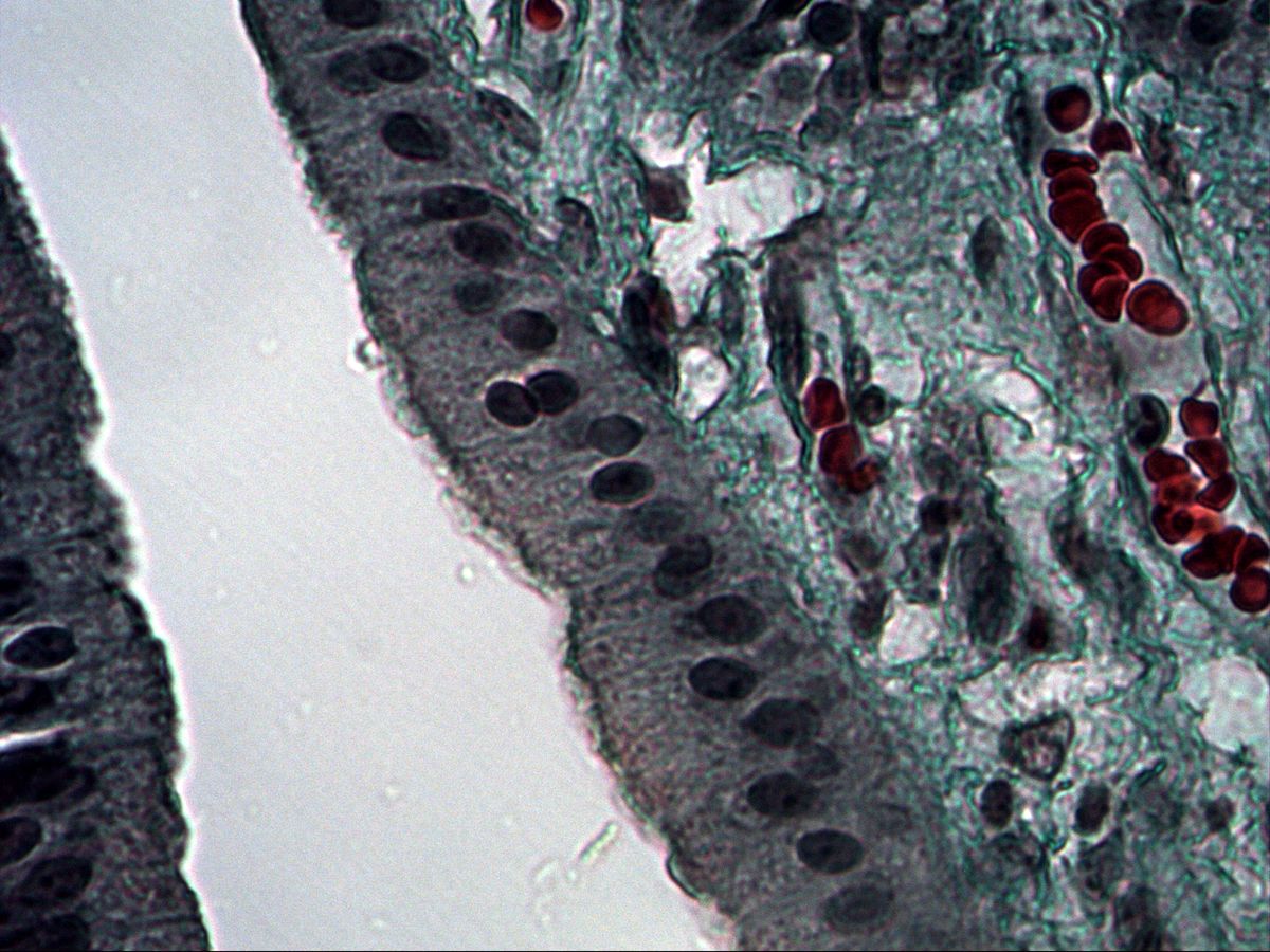 Gallbladder, trichrome, high magnification: columnar cells with elongated nuclei