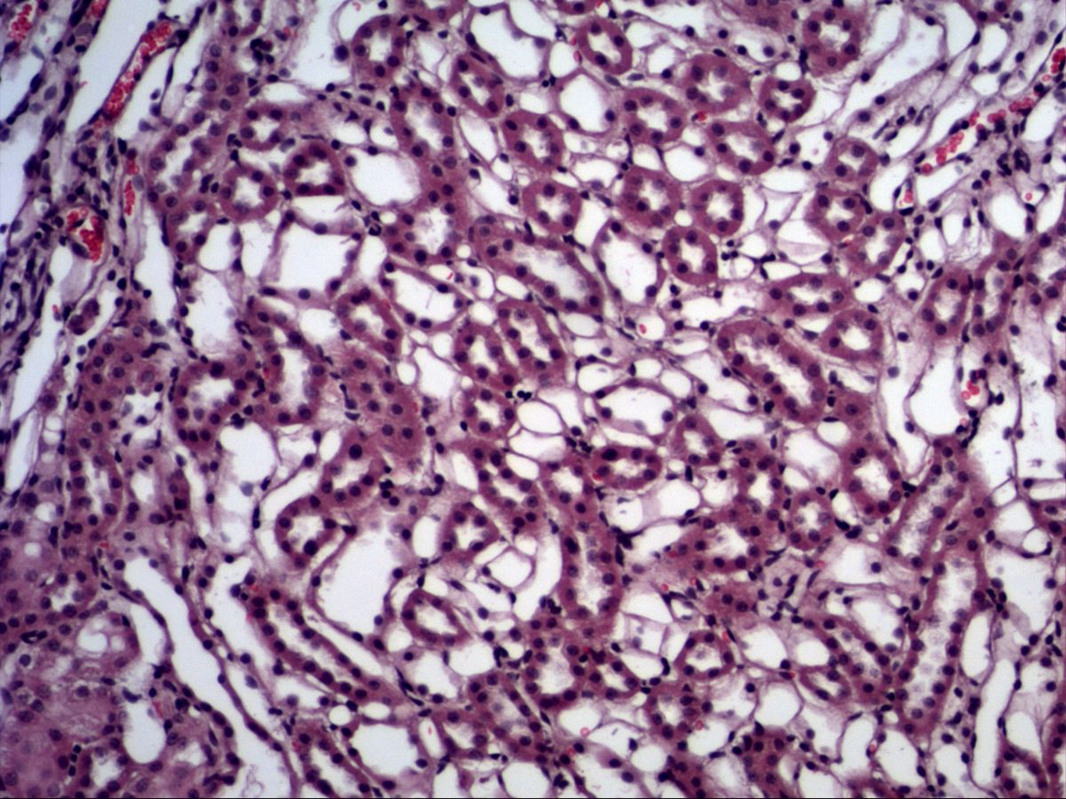 Kidney, H&E, medium magnification: tubules in cross-section and capillaries