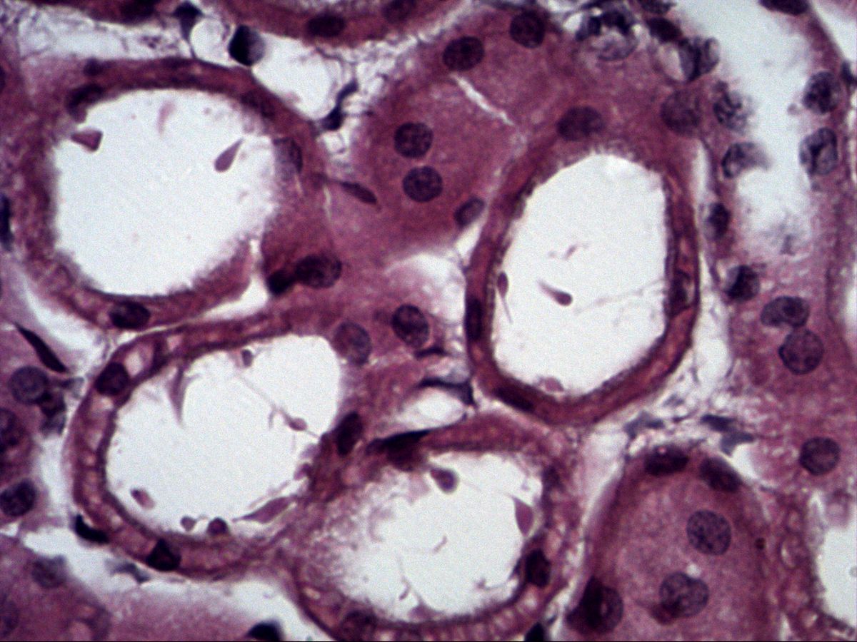 Kidney, H&E, high magnification: tubule lumen, cuboidal cells with round nuclei
