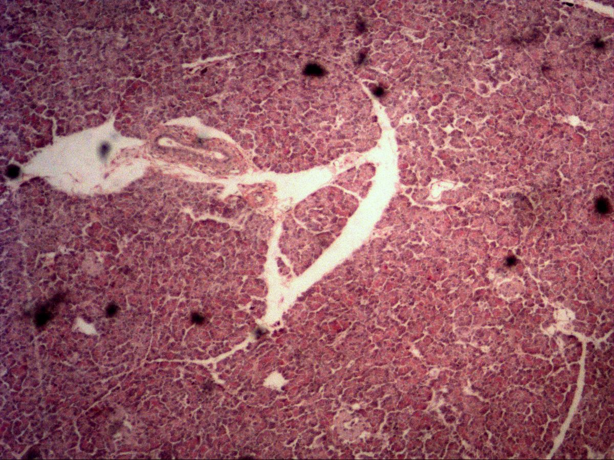 Pancreas, H&E, overview: exocrine acini, connective tissue septa and a small islet