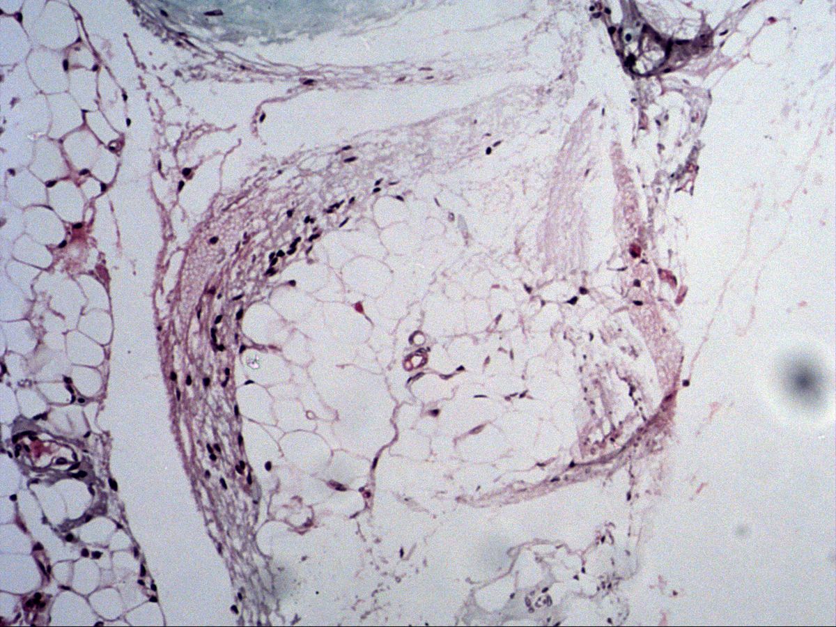 Adipose and loose connective tissue in a neurovascular bundle, trichrome stain, medium magnification