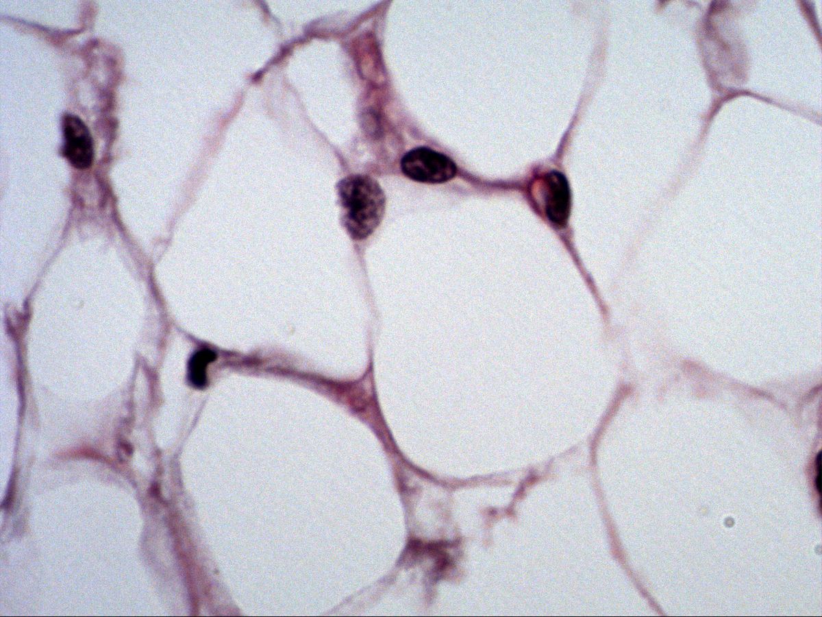 Unilocular fat cells with peripheral nuclei, trichrome stain, high magnification