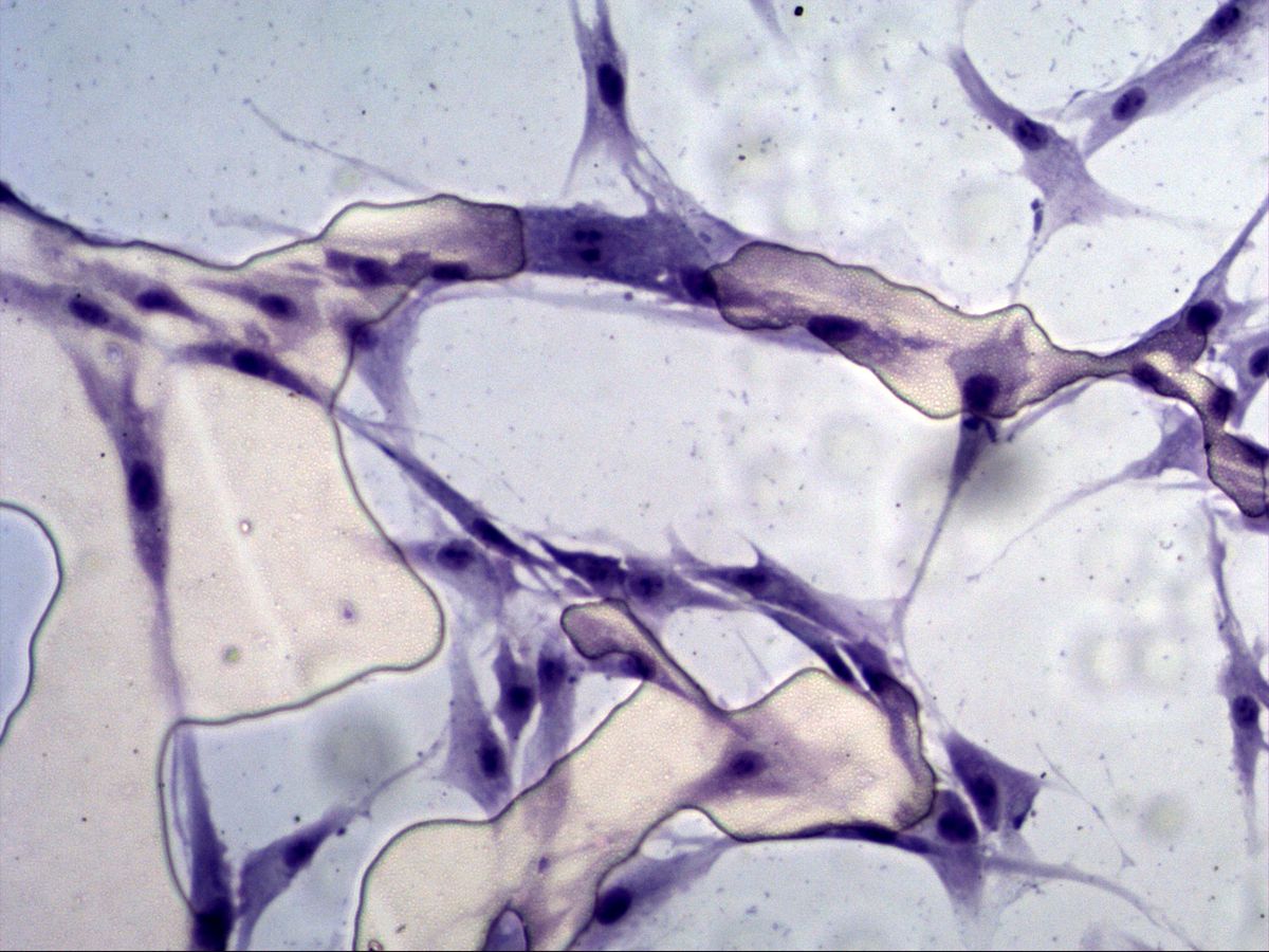 Branched fibroblasts with nuclei, cell culture, Giemsa, high magnification