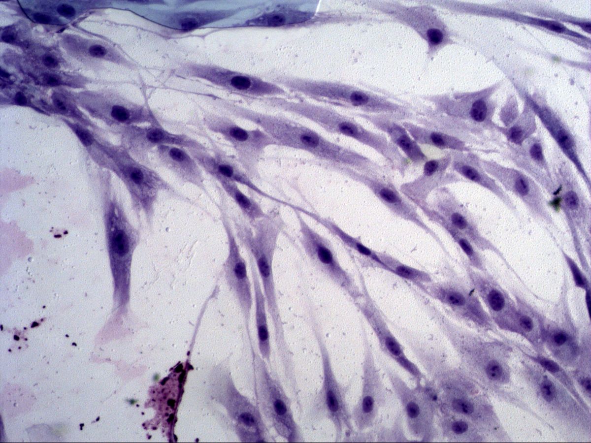 Fibroblasts with oval nuclei and long processes, cell culture, Giemsa, medium magnification