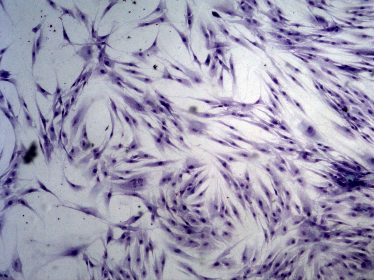 Fibroblasts in cell culture, Giemsa, overview with dense network of spindle-shaped cells