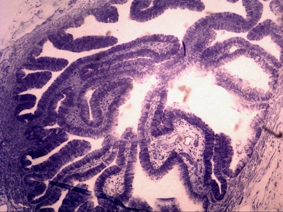 Uterine tube, semithin section, toluidine blue, overview: branching mucosal folds