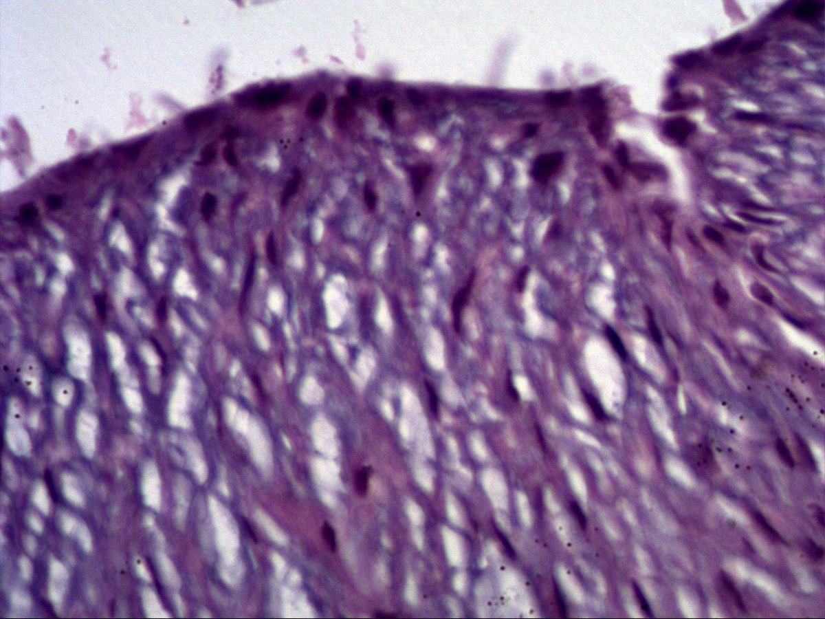 Amniotic epithelium and mucous connective tissue of the umbilical cord, H&E, high magnification