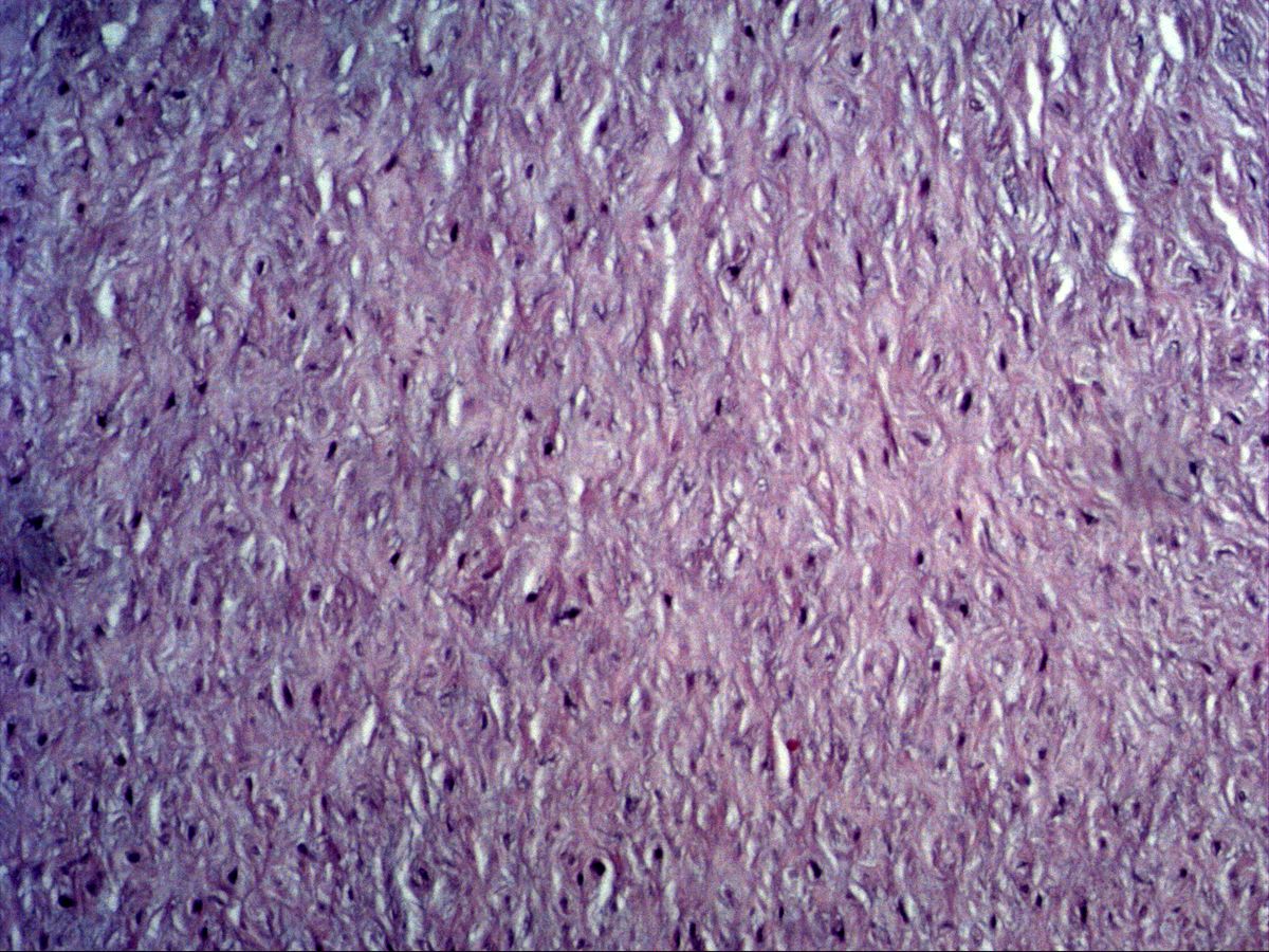 Wharton's jelly with fibroblasts in ground substance, umbilical cord, H&E, medium magnification