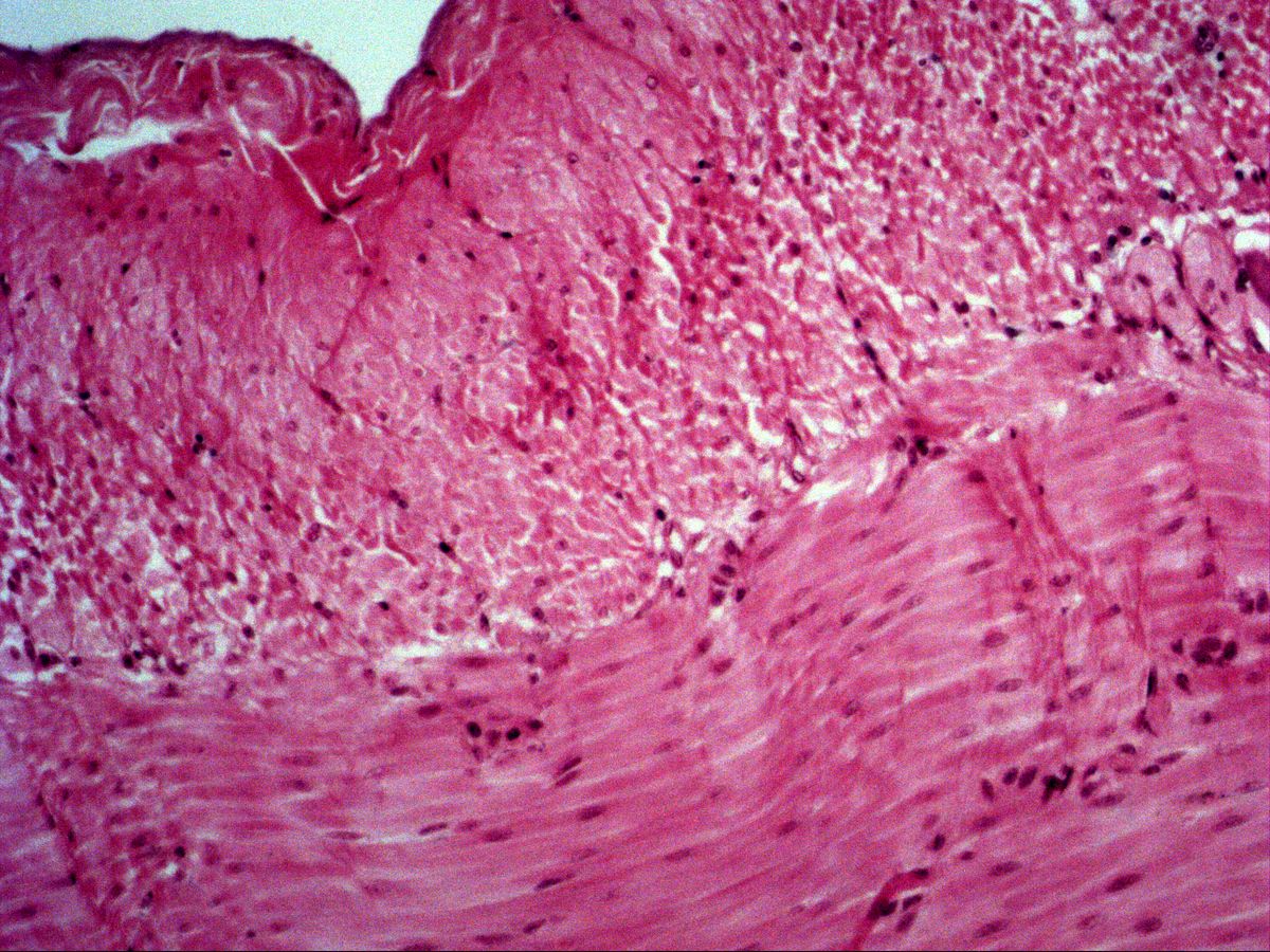 Smooth muscle of the ileum, H&E, medium magnification: transversely and longitudinally cut muscle layers
