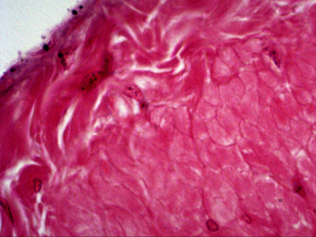 Smooth muscle cells in cross-section beneath the serosa, H&E, high magnification