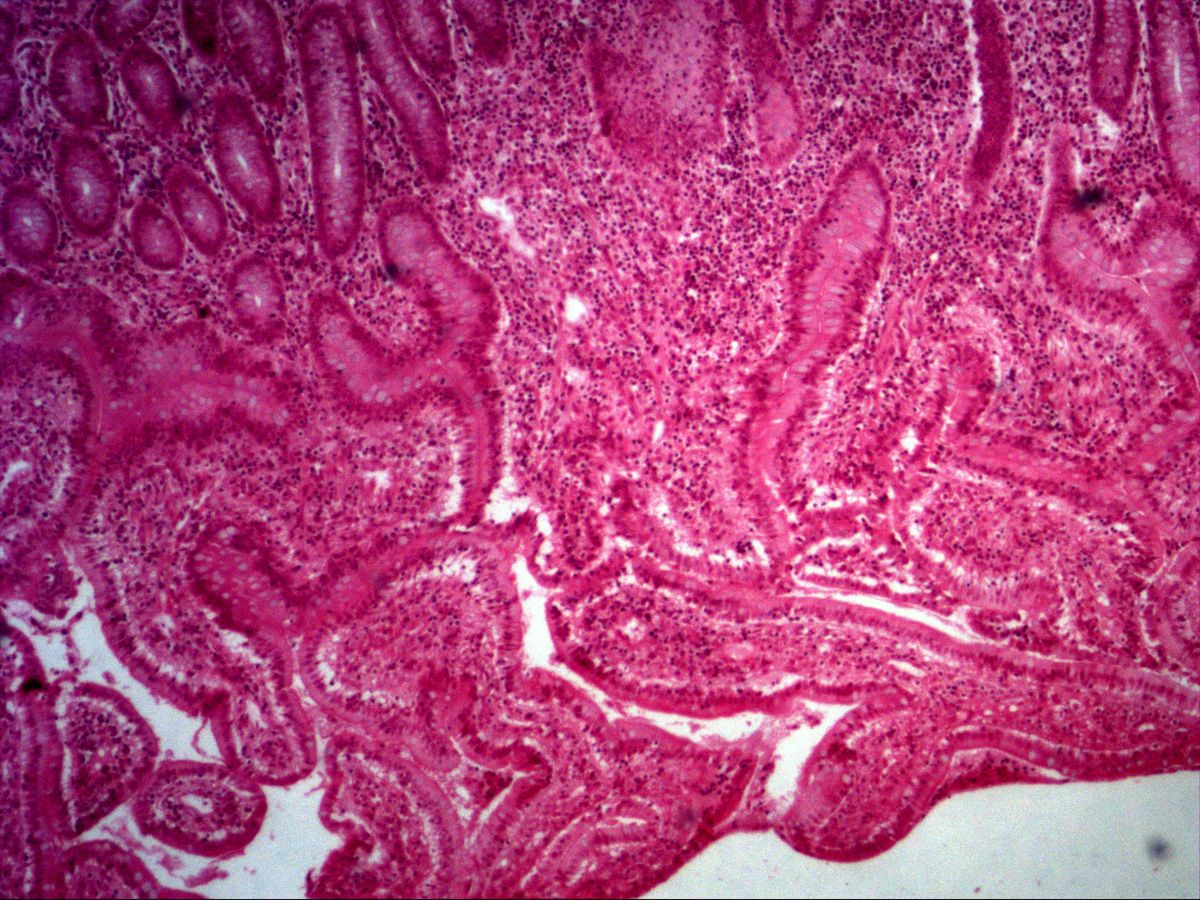 Ileal mucosa with villi and crypts, H&E, overview
