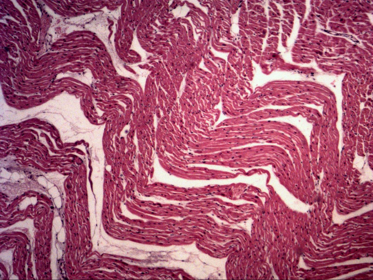 Myocardium, H&E, medium magnification, wavy cardiac muscle bundles