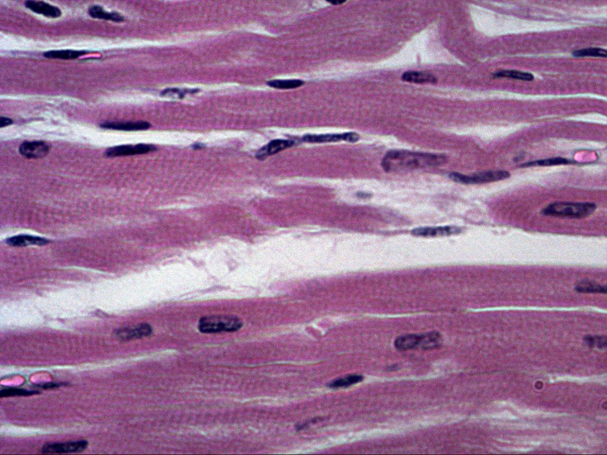 Cardiomyocytes in longitudinal section, H&E, high magnification, central nuclei and striation