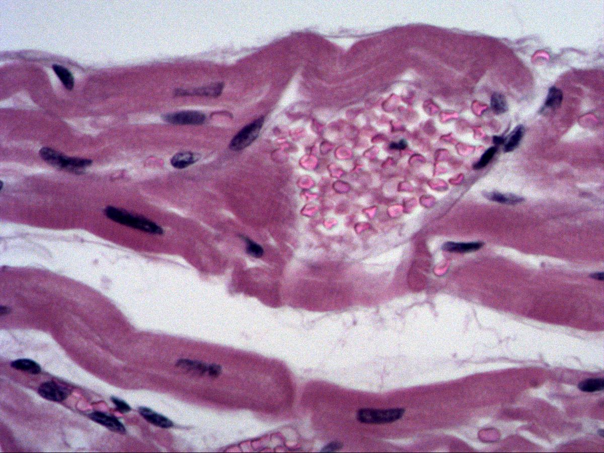 Myocardium, H&E, high magnification, blood vessel with erythrocytes between cardiomyocytes