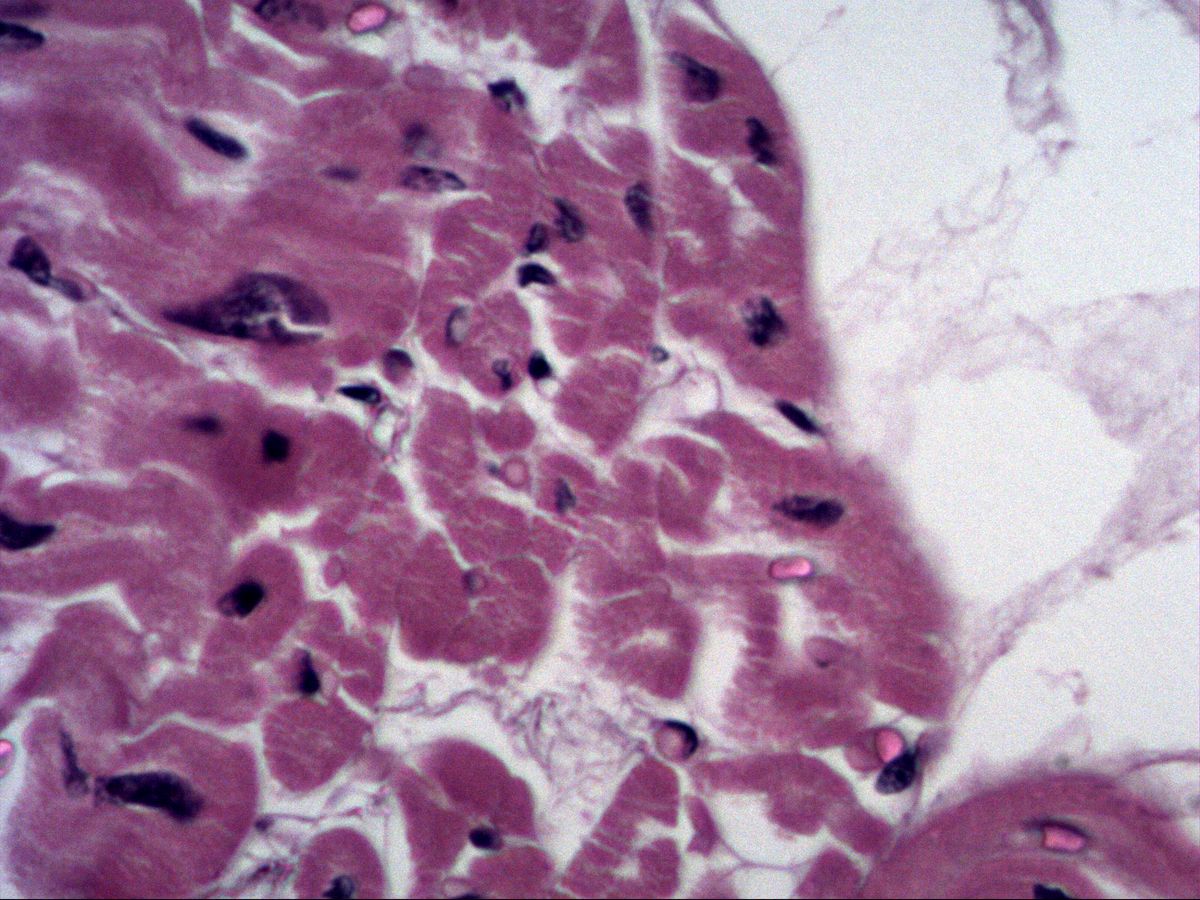 Cardiomyocytes in cross-section, H&E, high magnification, central nuclei