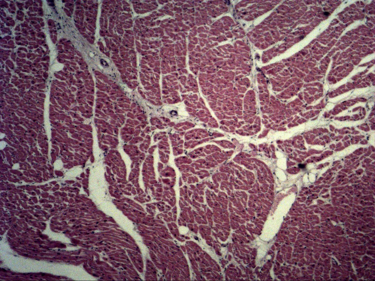 Myocardium, H&E, overview, cross-cut cardiac muscle bundles with connective tissue septa