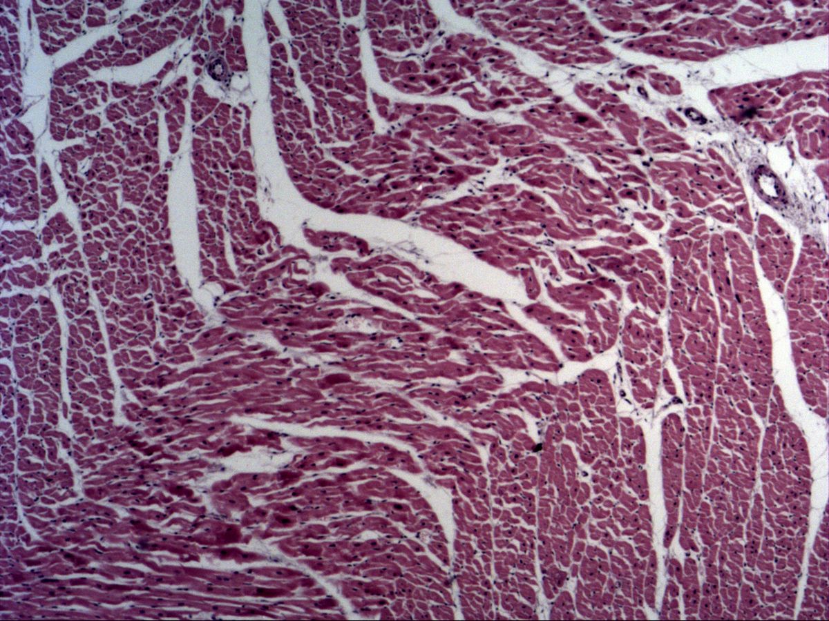 Myocardium, H&E, overview, cardiac muscle bundles in various directions