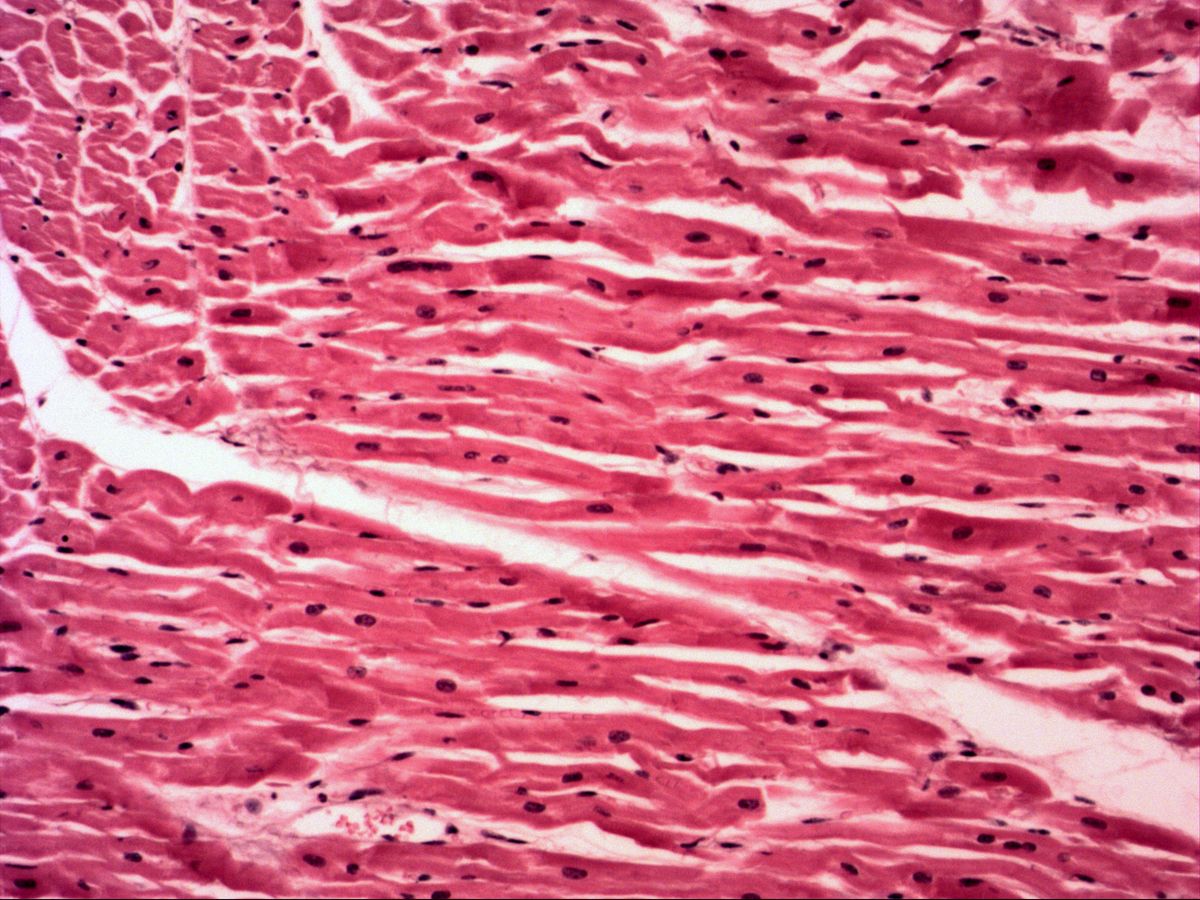 Cardiac muscle in longitudinal section, H&E, medium magnification, central nuclei
