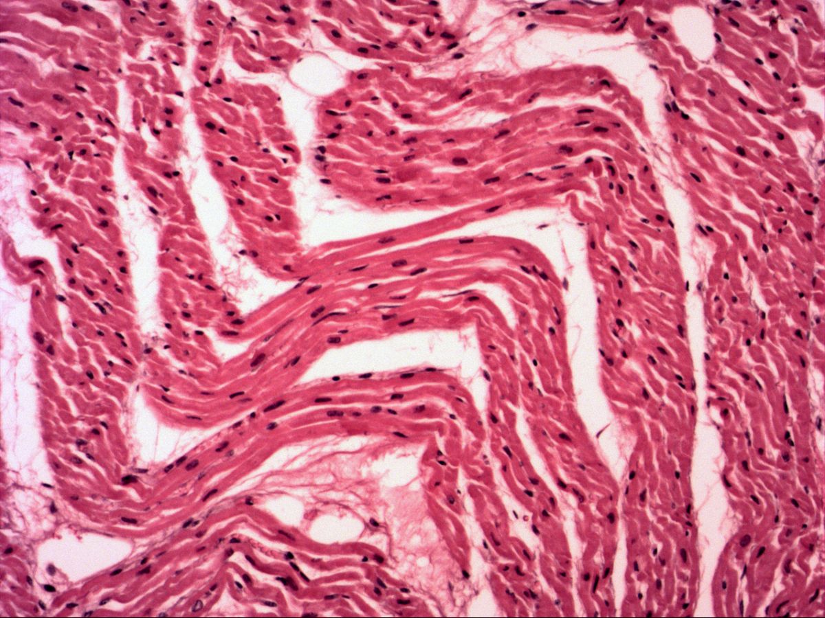 Cardiac muscle, H&E, medium magnification, wavy fibre bundles