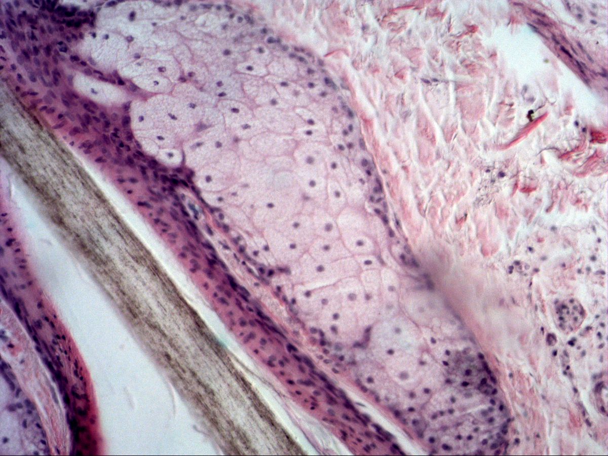 Scalp, H&E: hair shaft with root sheath and adjacent sebaceous gland in the dermis