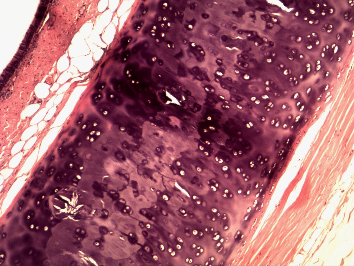 Trachea, H&E, overview with respiratory epithelium, fat cells, hyaline cartilage ring and perichondrium
