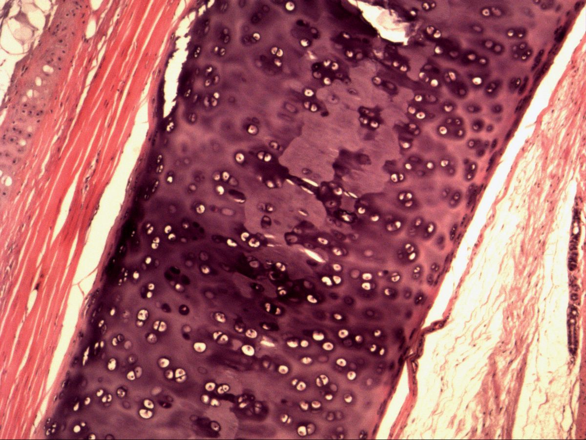 Hyaline cartilage of the trachea, H&E, medium magnification with chondrons and perichondrium