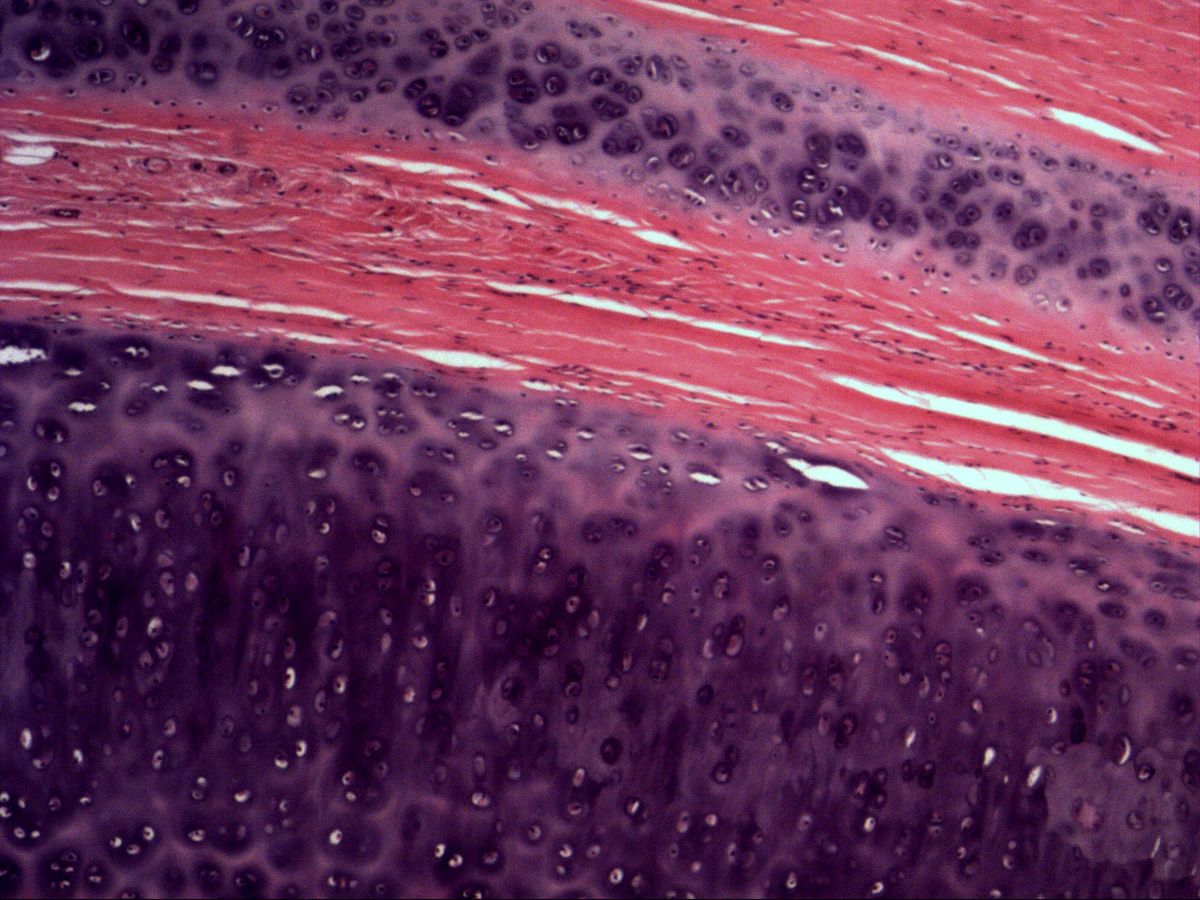 Hyaline cartilage with adjacent dense connective tissue, H&E, medium magnification