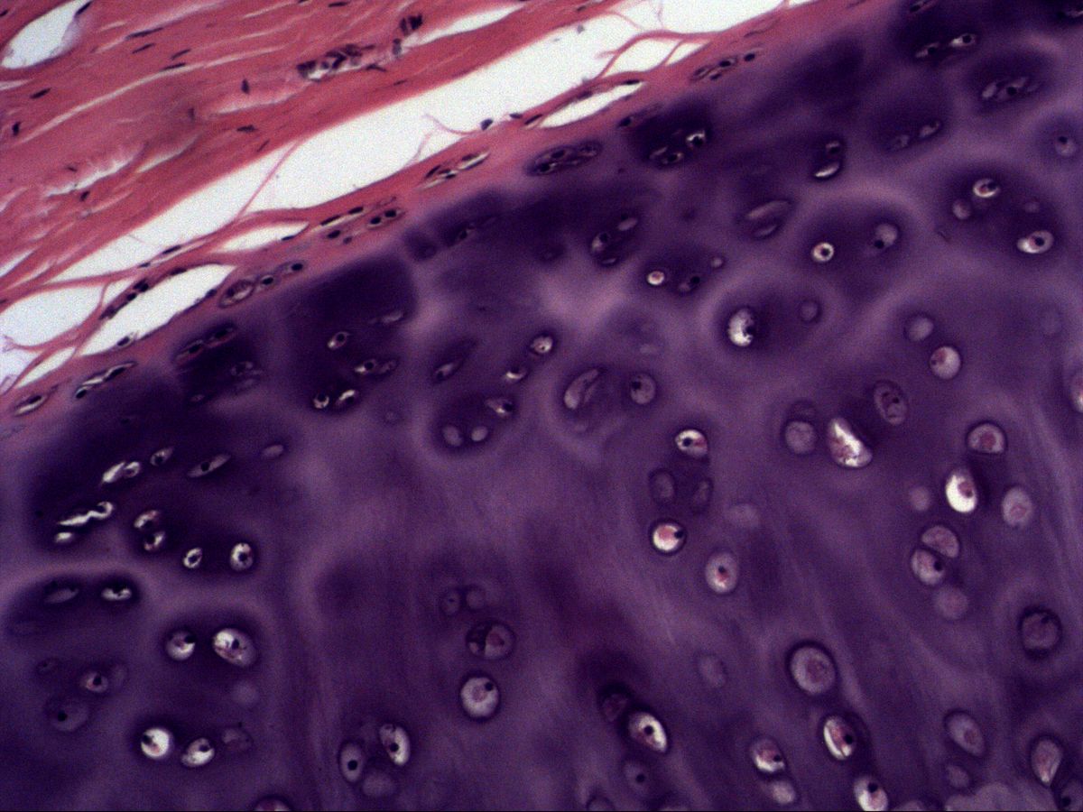 Perichondrium and hyaline cartilage, H&E, high magnification with flattened and rounded chondrocytes