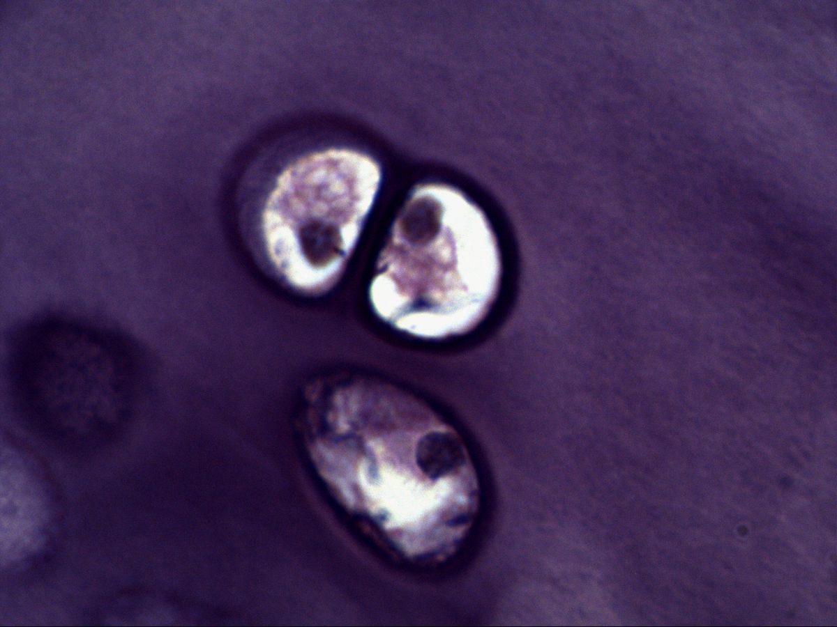 Isogenous group of three chondrocytes with capsule, hyaline cartilage, H&E, very high magnification