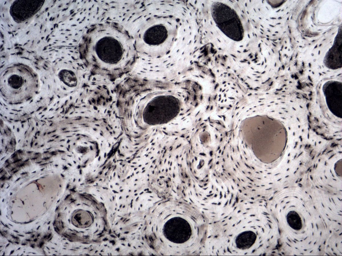 Bone ground section, compact bone transverse, overview with osteons, Haversian canals and osteocyte lacunae