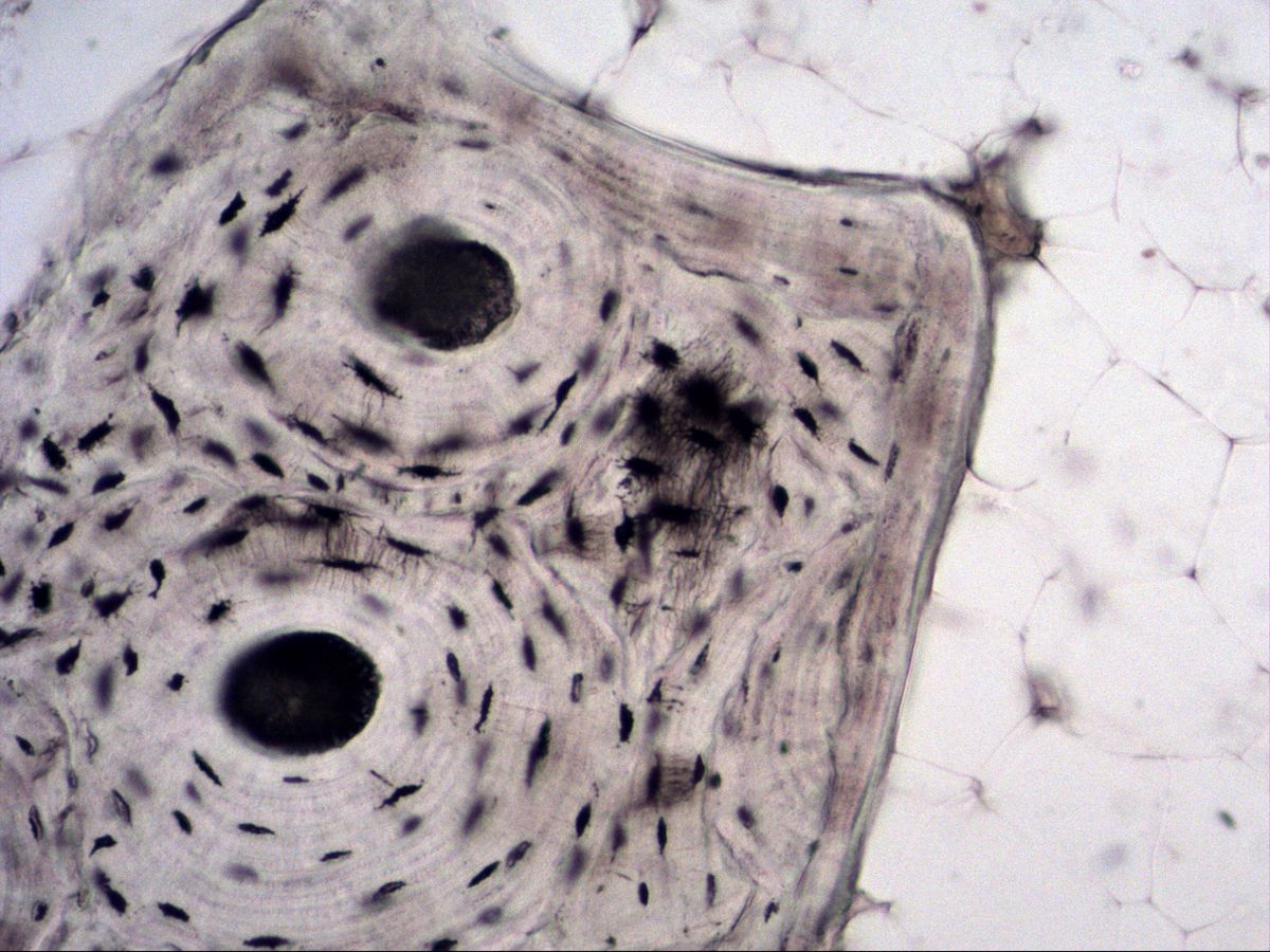 Bone ground section, edge of compact bone with osteons and circumferential lamellae, medium magnification