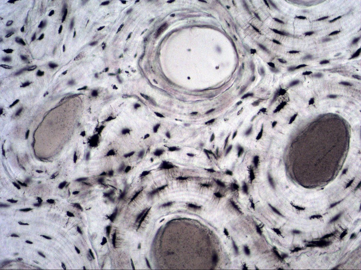 Osteon with Haversian canal and concentric lamellae in ground section, medium magnification