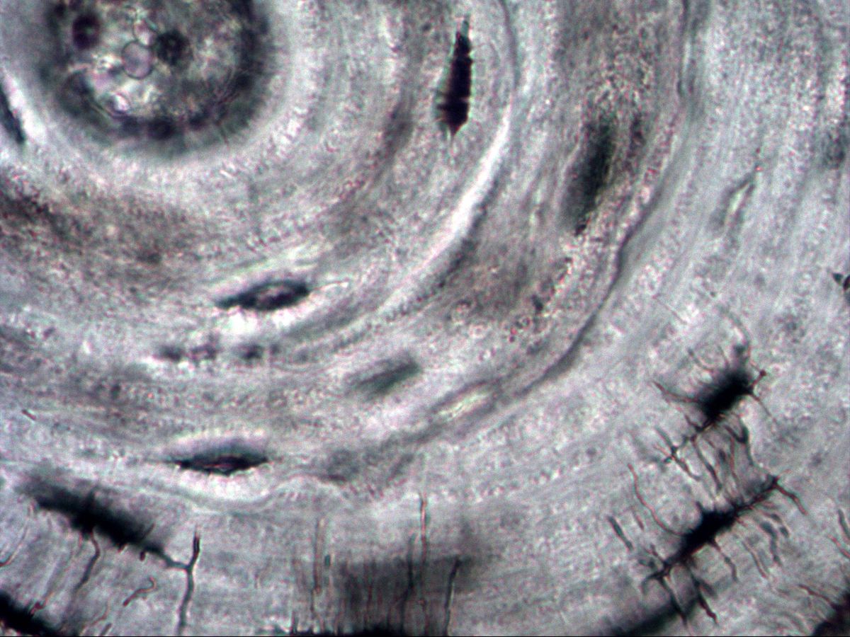 Lamellae and osteocyte lacunae with canaliculi, bone ground section, very high magnification